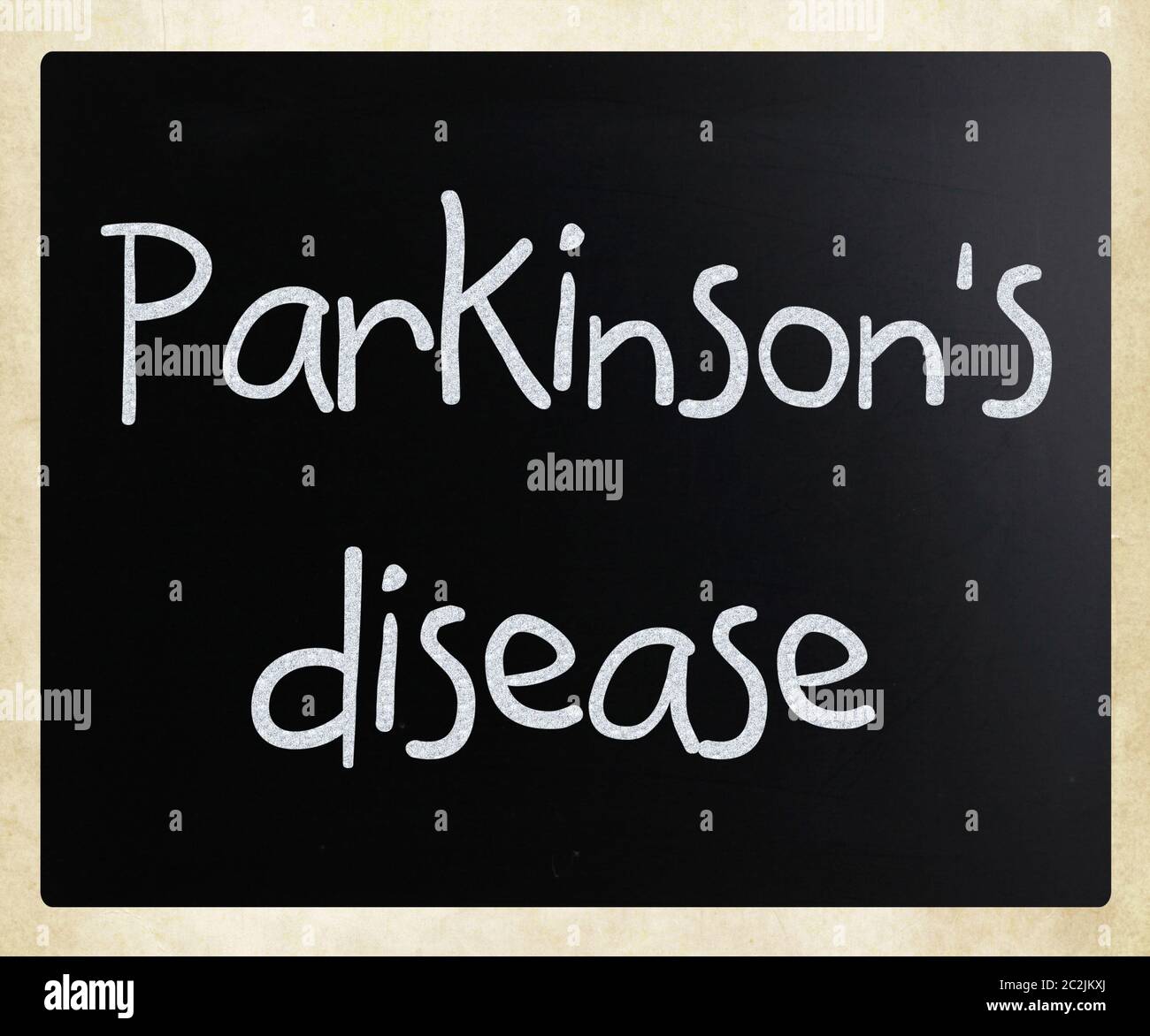 Parkinson-Erkrankung Stockfoto