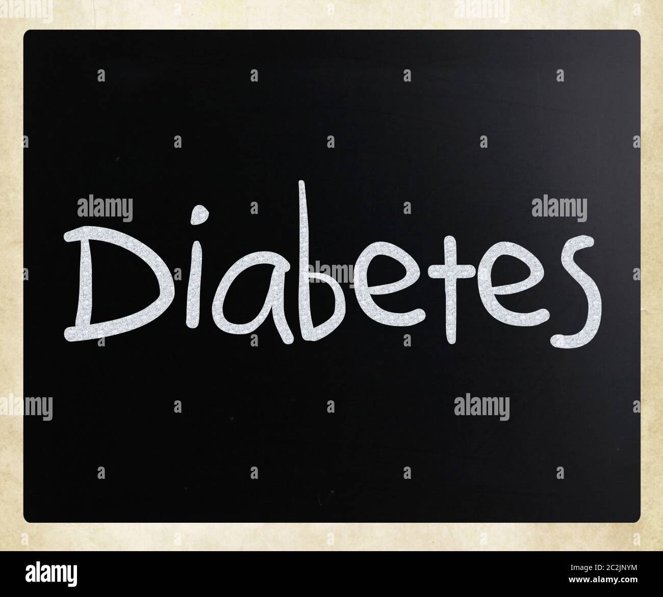 Das Wort "Diabetes" handschriftlich mit weißer Kreide auf einer Tafel Stockfoto