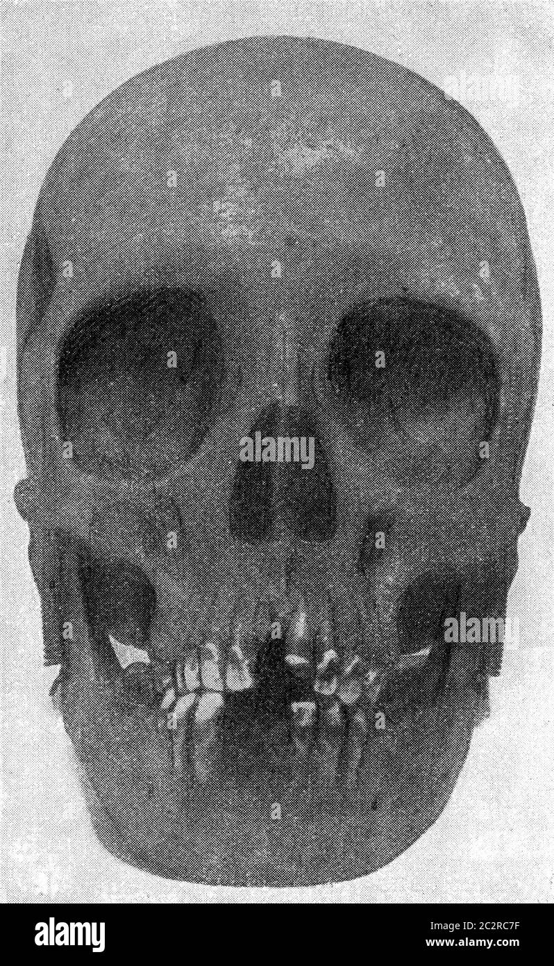 Schädel einer australischen Frau mit Augenbahnen ähnlich denen der Orang, Vintage graviert Illustration. Aus dem Universum und der Menschheit, 1910. Stockfoto