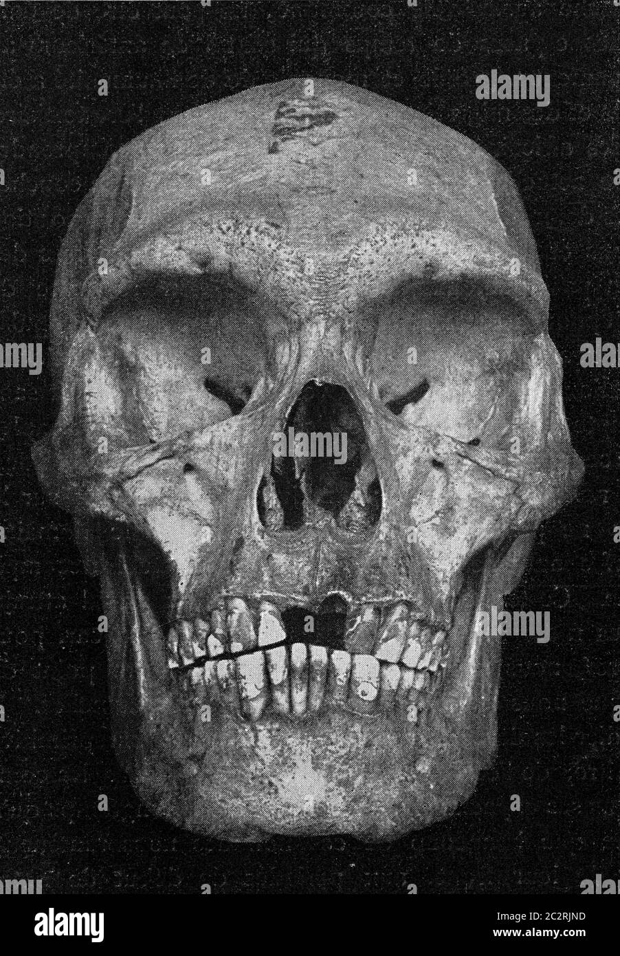 Schädel eines primitiven Australiers, die sehr ausgeprägte Tierspuren in der Konformation der Stirn erhalten haben, Vintage gravierte Illustration. Her Stockfoto