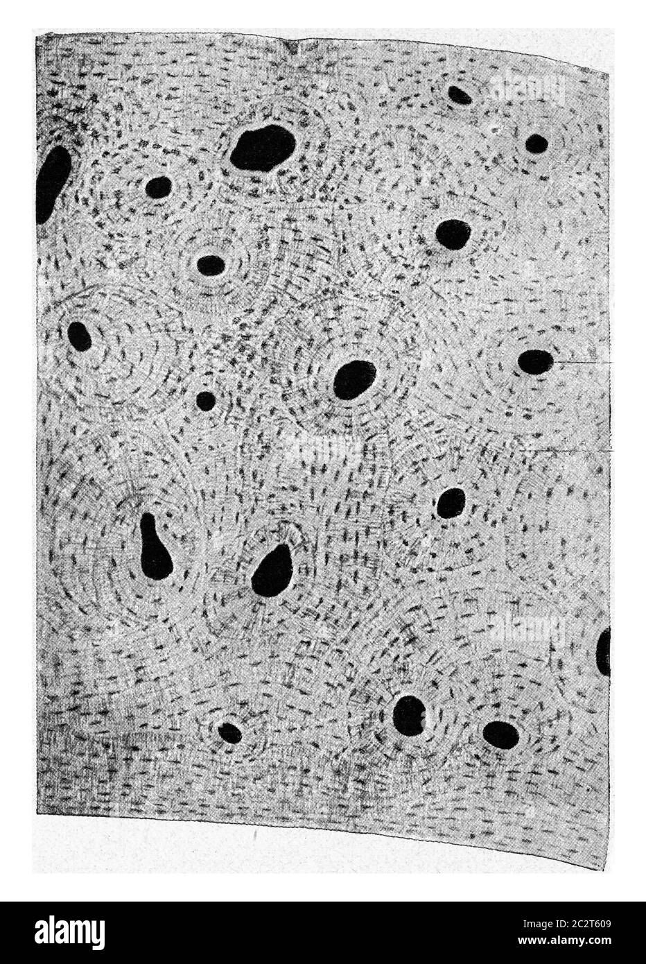 Fragment des transversalen Segments der parietalen Substanz eines menschlichen Femurs, vintage gravierte Abbildung. Aus dem Universum und der Menschheit, 1910. Stockfoto
