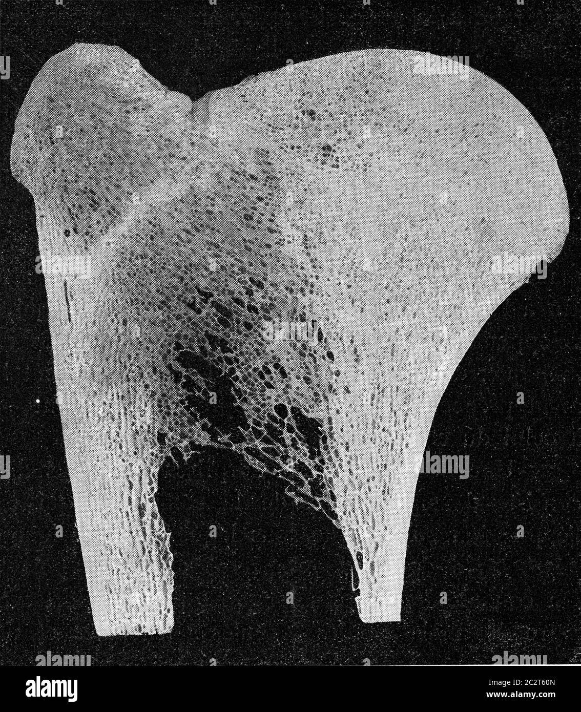 Längsschnitt durch den oberen Teil des Unterarms Knochen einer Giraffe, Vintage graviert Abbildung. Aus dem Universum und der Menschheit, 1910. Stockfoto