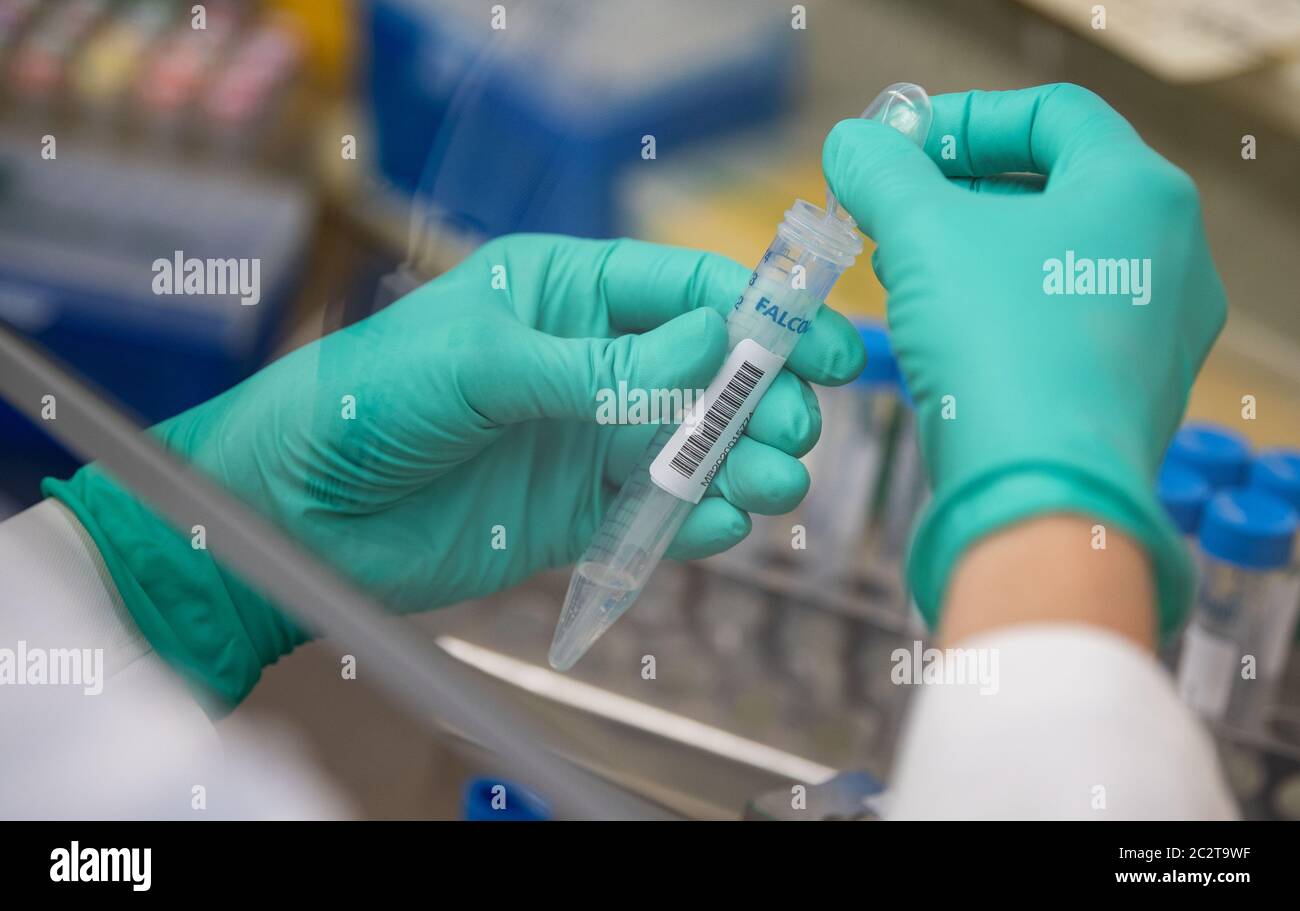 Stuttgart, Deutschland. Juni 2020. Ein Mitarbeiter des Landesgesundheitsamtes Baden-Württemberg pipettiert Corona-Proben bei einem Besuch des baden-württembergischen Ministerpräsidenten Kretschmann. Das Landesgesundheitsamt ist die Fachkontrollstelle für das Gesundheitswesen in Baden-Württemberg. Hier kommt die Corona-Krise zusammen. Quelle: Marijan Murat/dpa/Alamy Live News Stockfoto