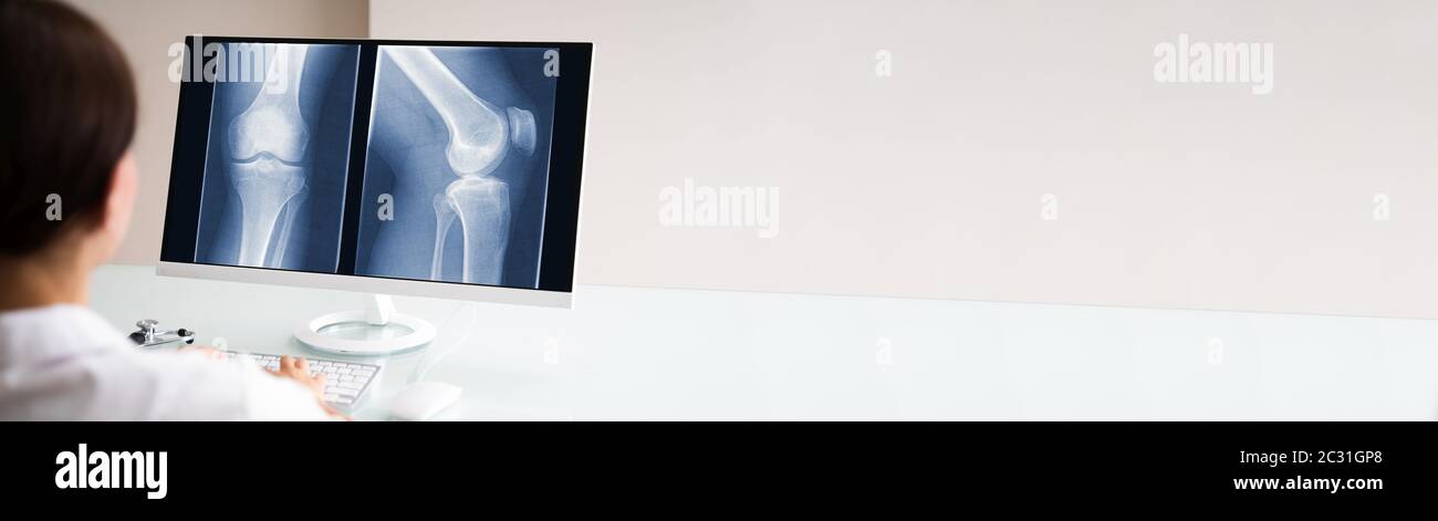 Chirurg Arzt Blick Auf Knie Knochen Röntgenaufnahme Stockfoto
