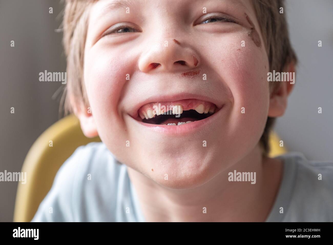 Zahnloser Junge lächelnd Stockfoto