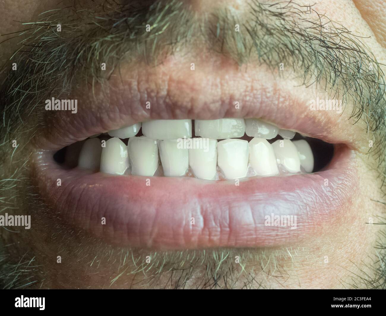 Fragment eines männlichen Gesichts mit leicht geöffnetem Mund und weißen Zähnen Stockfoto