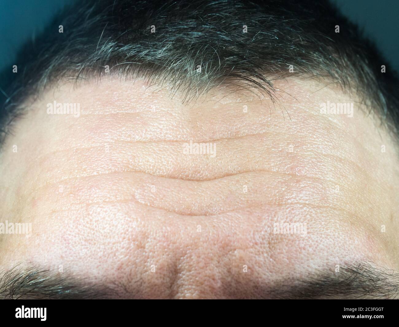 Nahaufnahme eines männlichen Stirns mit tiefen Falten und Poren Stockfoto