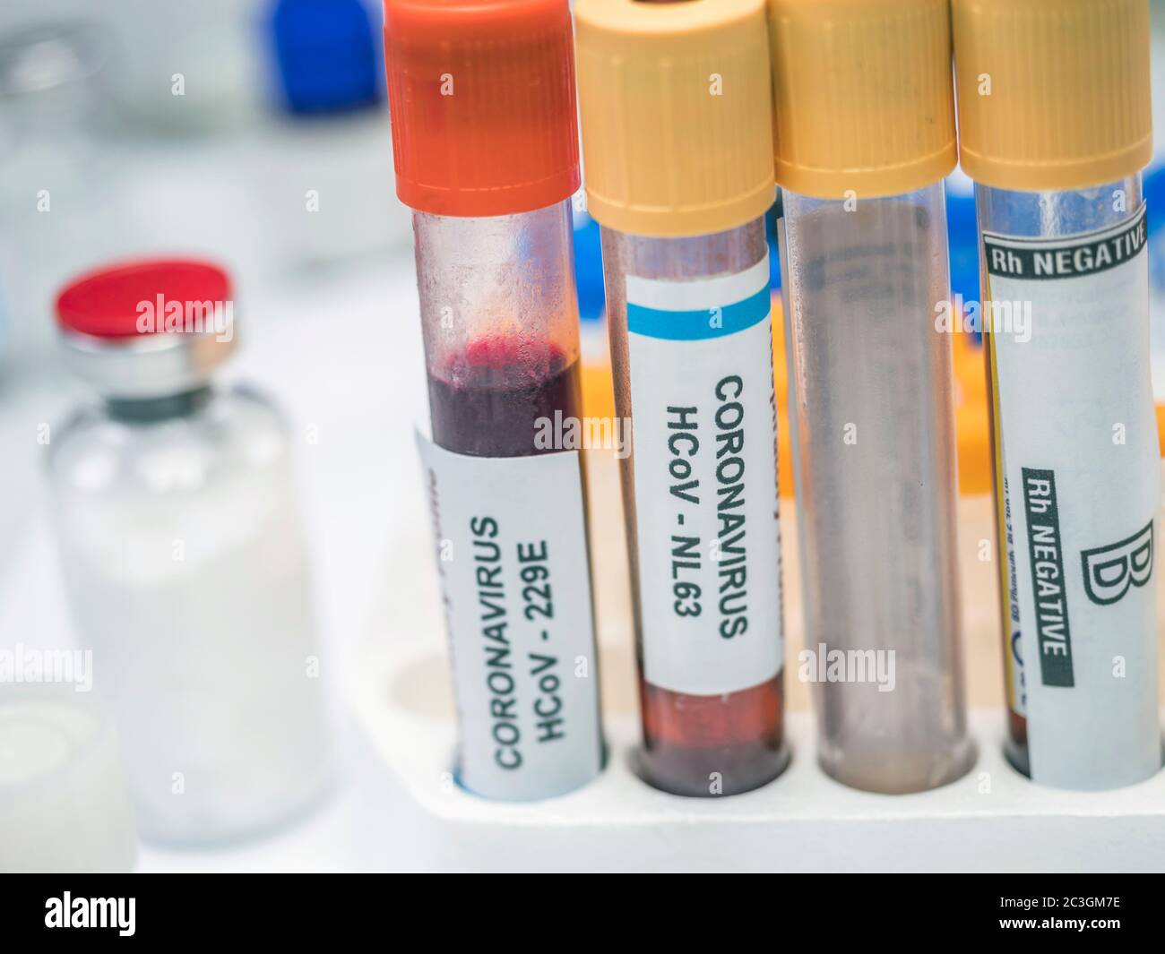 Auswahl von Blutproben zur Analyse von Patienten, die mit sars-Cov-2 infiziert sind, konzeptuelles Bild Stockfoto