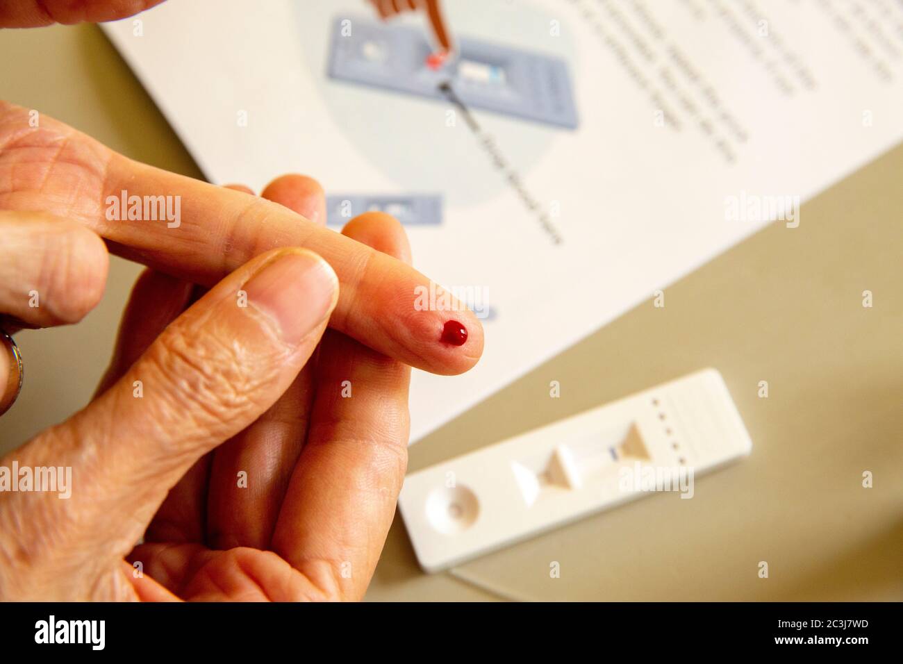 COVID-19-Kit für die Untersuchung von Antikörpern zu Hause. Ein Tropfen Blut nach dem Finger wird mit der Lanzette gestochen. Das Kit enthält COVID-19 Teststab, Lanzetten, Pufferflüssigkeit, Pipette und Alkoholtupfer. React-Studientest für positive IgG-, IgM-Ergebnisse oder negative Antikörpertests. Stockfoto