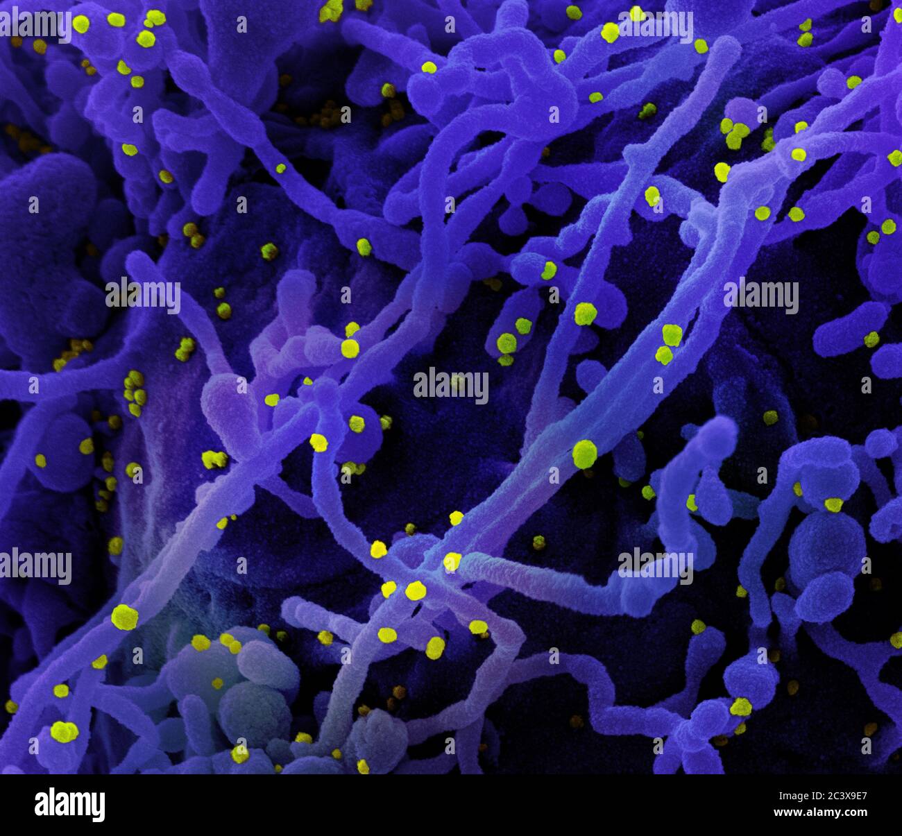 Neues Coronavirus SARS-CoV-2 Koloriertes Rasterelektronenmikroskopisch einer Zelle (violett), die mit SARS-COV-2-Viruspartikeln (gelb) infiziert ist und aus einer Patientenprobe isoliert wurde. Aufnahme in der NIAID Integrated Research Facility (IRF) in Fort Detrick, Maryland. Stockfoto