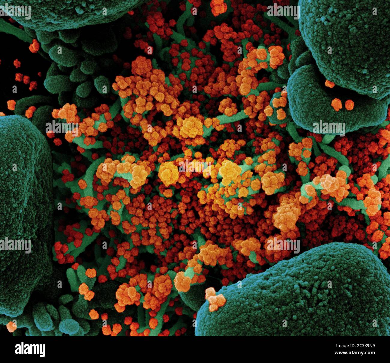 Neues Coronavirus SARS-CoV-2 Koloriertes Rasterelektronenmikroskopisch einer Apoptose (grün), die stark mit SARS-COV-2-Viruspartikeln (orange) infiziert ist und aus einer Patientenprobe isoliert wurde. Bild an der NIAID Integrated Research Facility (IRF) in Fort Detrick, Maryland. Stockfoto