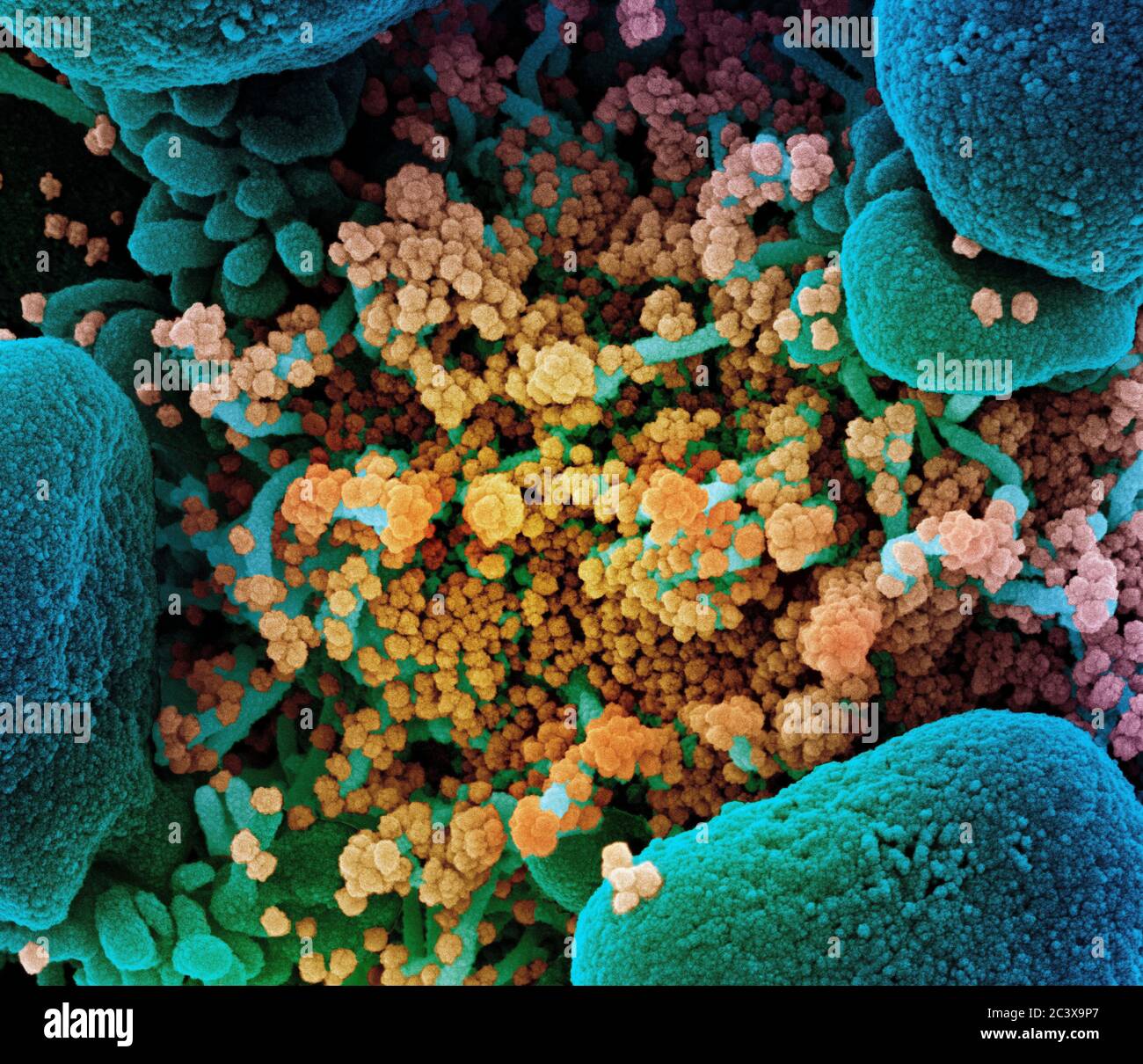 Neues Coronavirus SARS-CoV-2 Koloriertes Rasterelektronenmikroskopisch einer Apoptose (blau), die mit SARS-COV-2-Viruspartikeln (gelb) stark infiziert ist und aus einer Patientenprobe isoliert wurde. Aufnahme in der NIAID Integrated Research Facility (IRF) in Fort Detrick, Maryland. Stockfoto