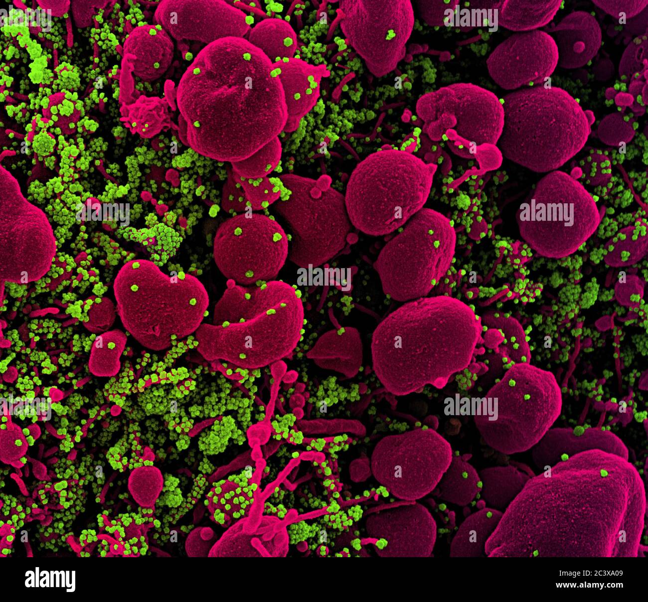 Neues Coronavirus SARS-CoV-2 Koloriertes Rasterelektronenmikroskopisch einer Apoptose (rosa), die mit SARS-COV-2-Viruspartikeln (grün) stark infiziert ist und aus einer Patientenprobe isoliert wurde. Aufnahme in der NIAID Integrated Research Facility (IRF) in Fort Detrick, Maryland. Stockfoto
