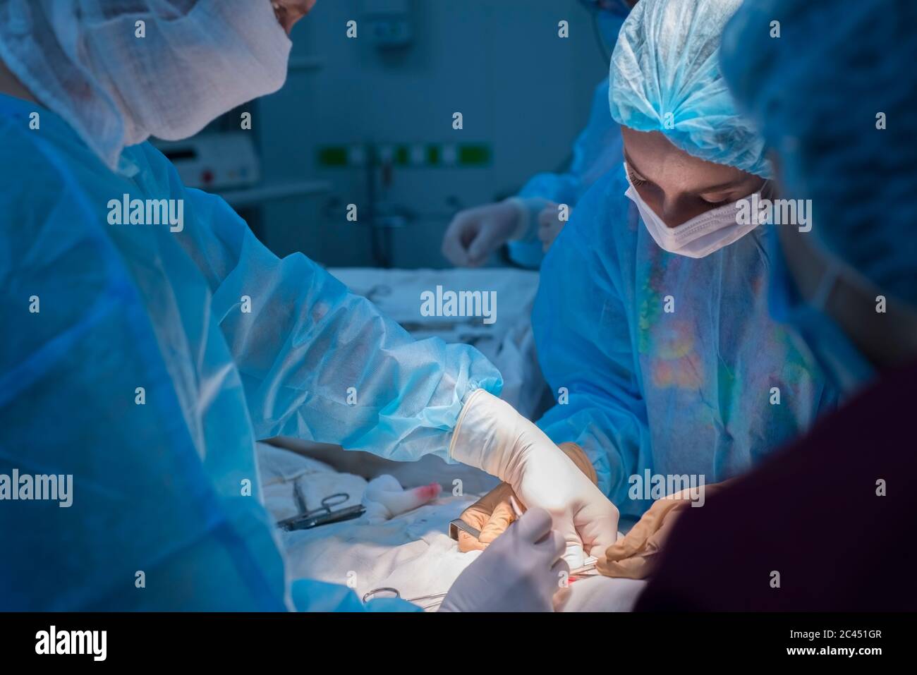 Kinderchirurgen führen urologische Operationen durch. Ein Mann und eine Frau in einer Maske und einem blauen sterilen Gewand im Operationssaal. Stockfoto