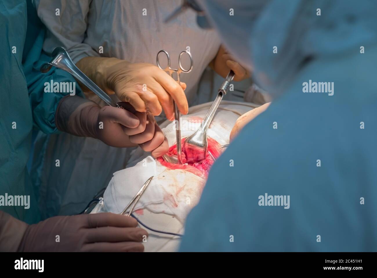 Ein Chirurg mit Assistenten, in einem sterilen Operationssaal, wird an inneren Organen operiert. Stockfoto