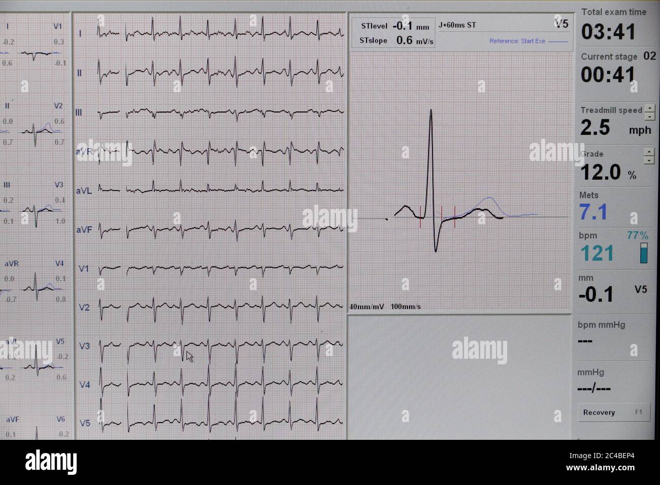 Kardiologie-Test Stockfoto