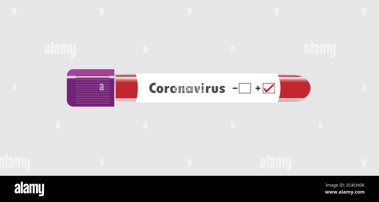 Coronavirus covid 19 infizierte Blutfläschchen. Corona Virus covid 19 Forschungslabor, Coronavirus covid-19 Impfstoffforschung Stock Vektor