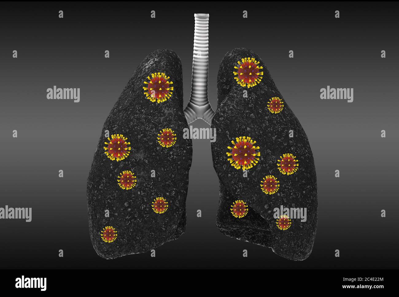 3D-Renderbild einer Corona-Virus-Infektion in der Lunge Stockfoto