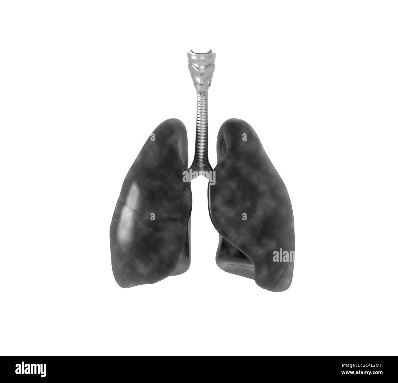 3D-Darstellung einer infizierten Lunge Stockfoto