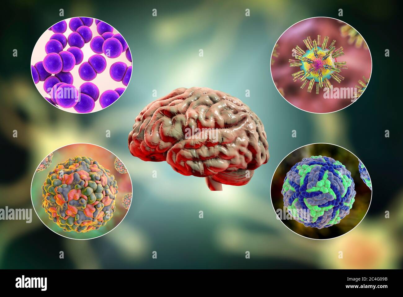 Hirninfektionen. Computer-Illustration von Mikroorganismen, die Enzephalitis und Meningitis verursachen. Stockfoto