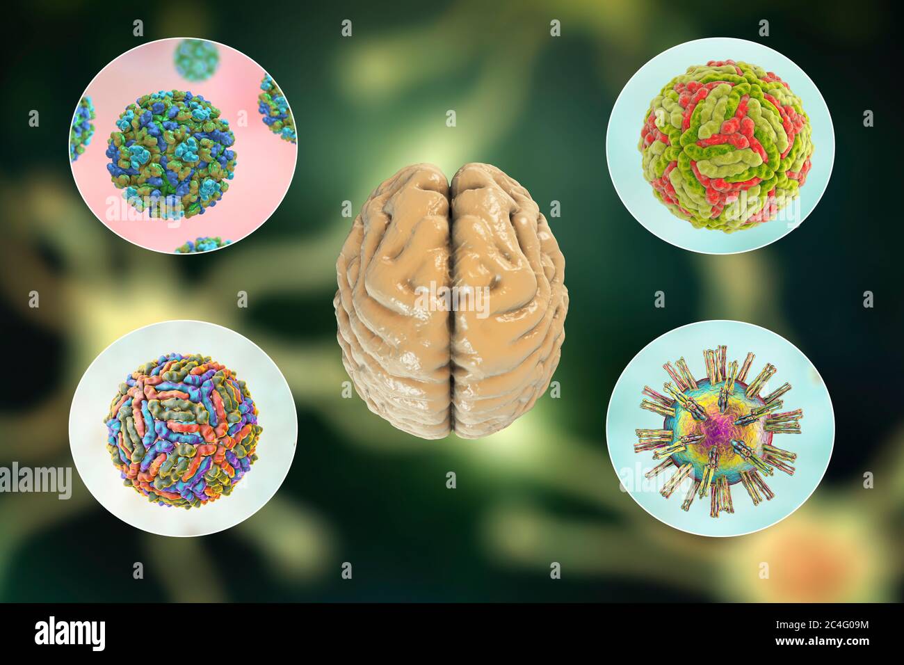 Hirninfektionen. Computer-Illustration von Mikroorganismen, die Enzephalitis und Meningitis verursachen. Stockfoto