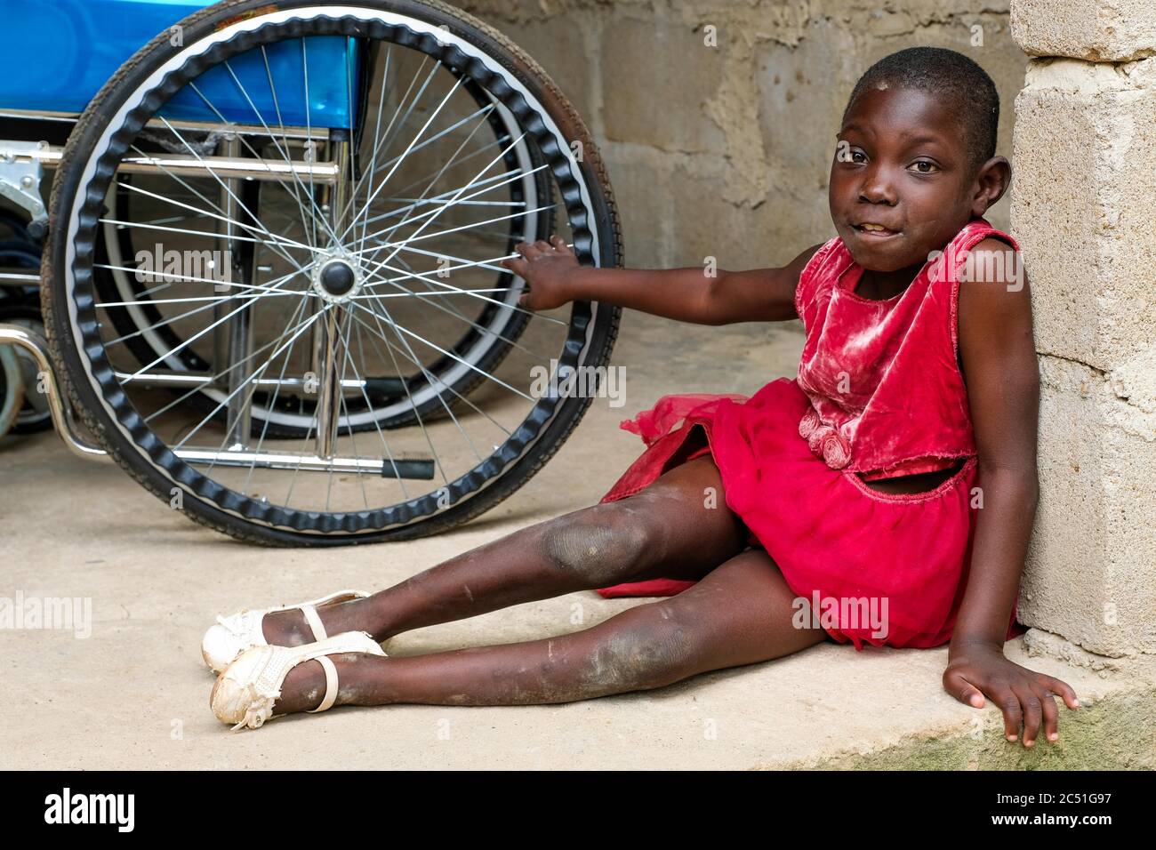 Körperlich behinderte Waise sitzt neben ihrem Rollstuhl im Nazareth Home for God´s Children in Sang, Ghana Stockfoto