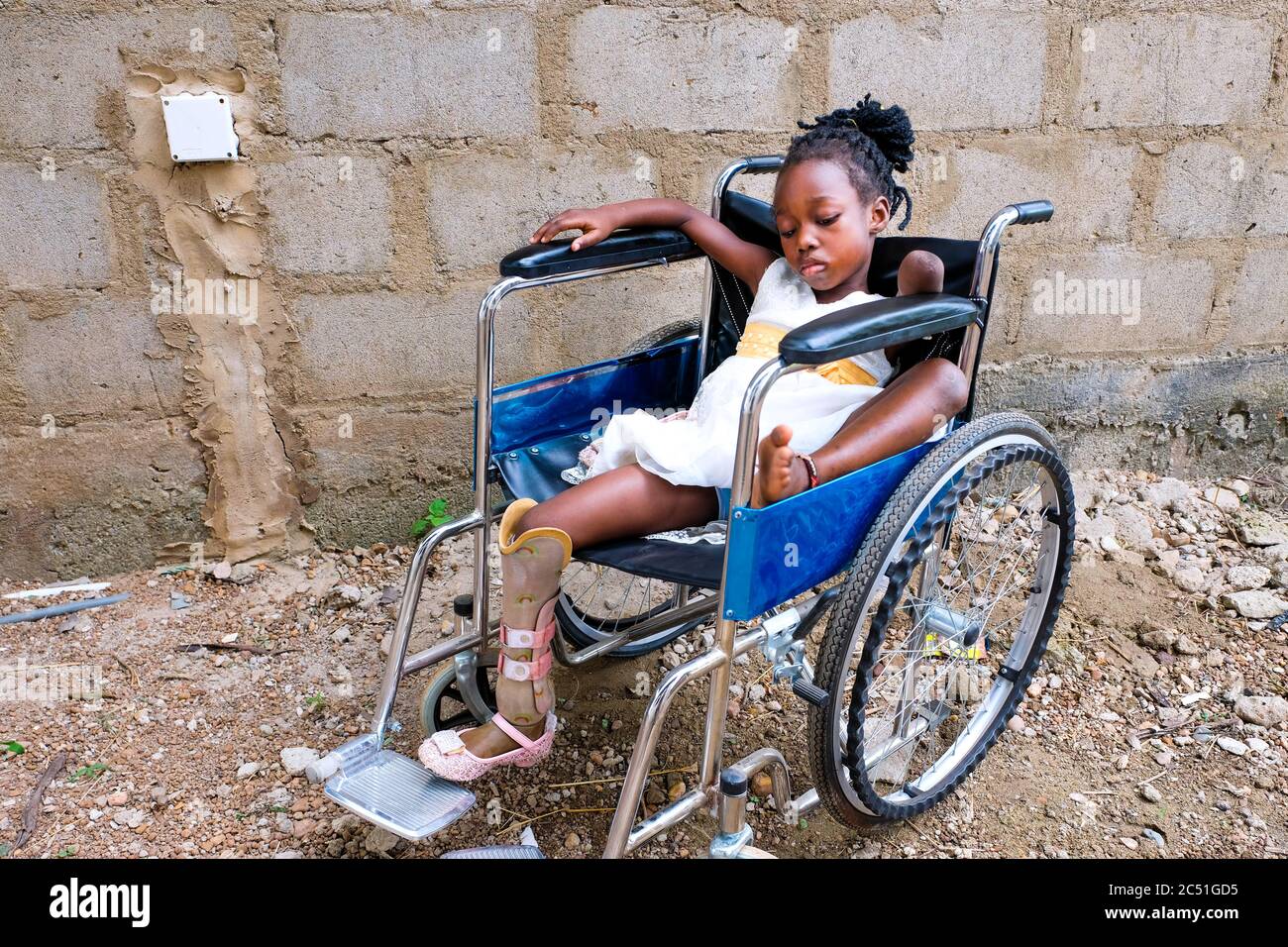 Körperlich behinderte Waise Precious (8) sitzt im Rollstuhl im Nazareth Home for God´s Children in Sang, Ghana Stockfoto