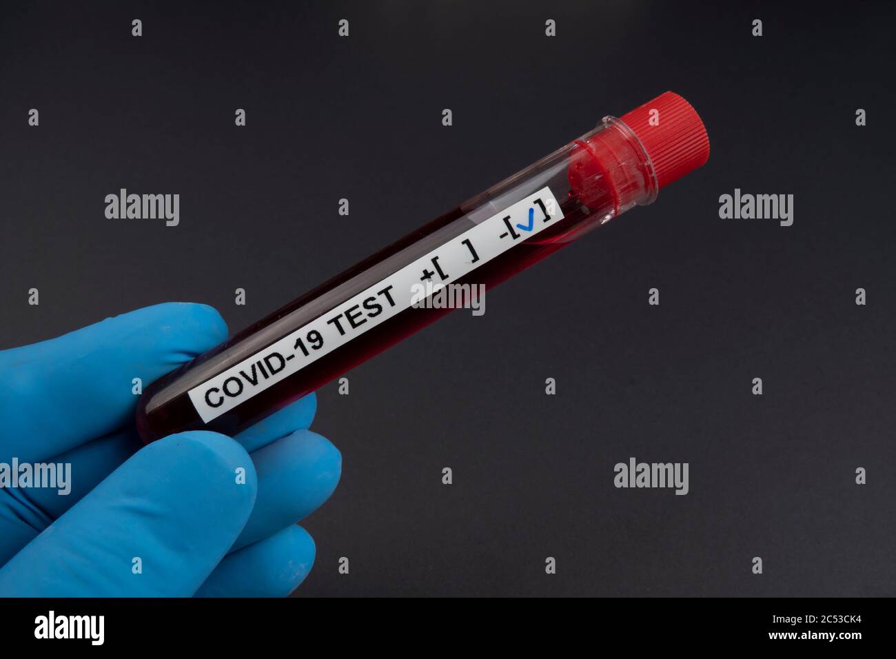 Laborian's Hand zeigt ein negatives Ergebnis covid-19 Reagenzglas in schwarzem abstrakten Hintergrund. Stockfoto