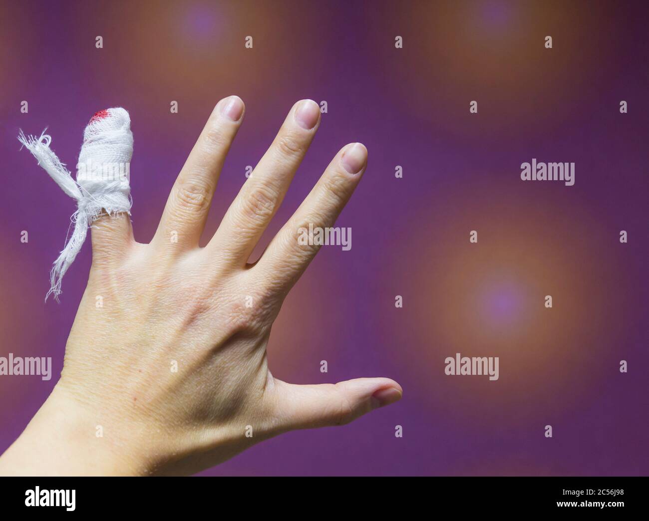 Nahaufnahme ? Eine weibliche Hand mit verletzten blutenden Fingern mit blutiger Gaze darauf. Stockfoto