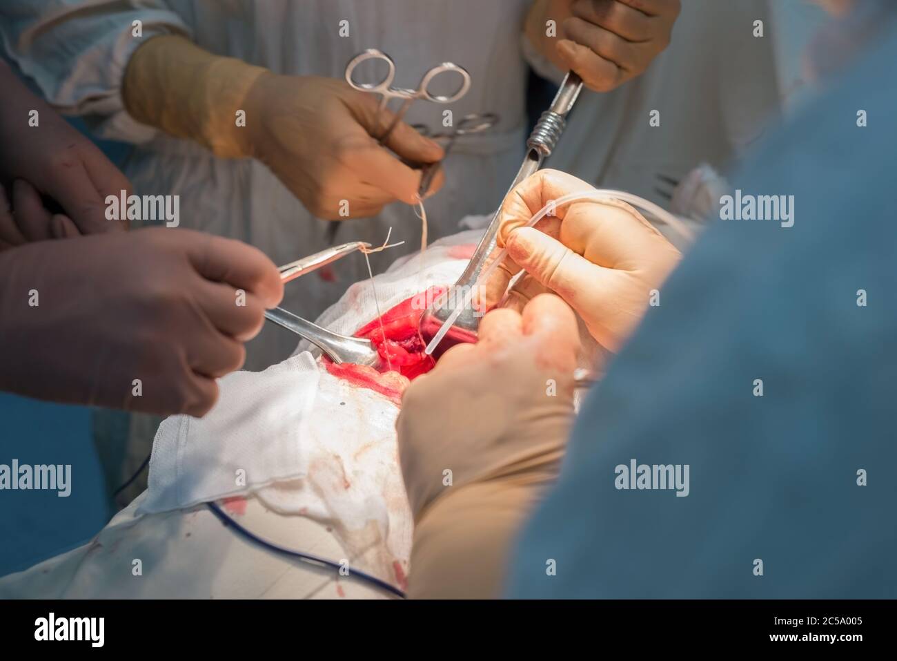 Ein Chirurg mit Assistenten, in einem sterilen Operationssaal, wird an inneren Organen operiert. Stockfoto