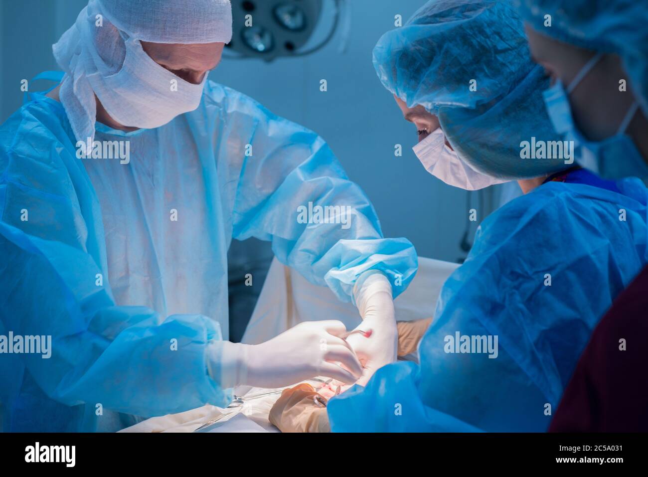 Kinderchirurgen führen urologische Operationen durch. Ein Mann und eine Frau in einer Maske und einem blauen sterilen Gewand im Operationssaal. Stockfoto