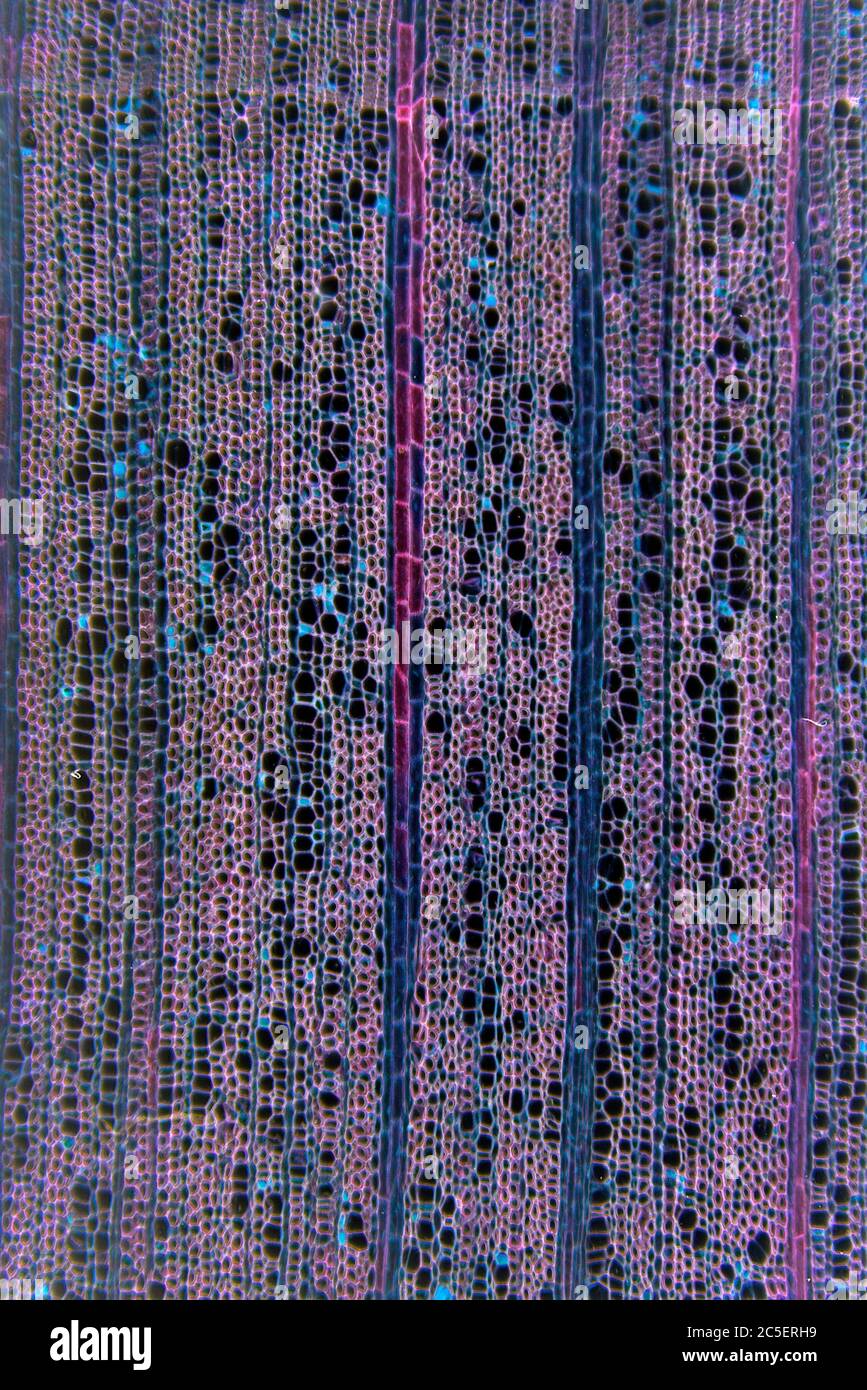 Dunkelfeld-Photomikrograph, zeigt Zellstruktur des Stammes, Ilex aquafolia Linn, Holly Stockfoto