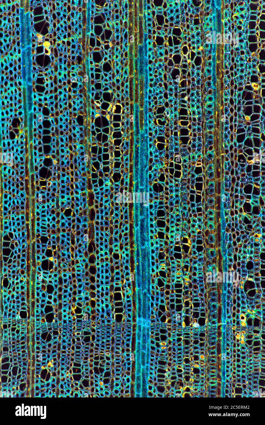 Dunkelfeld-Photomikrograph, zeigt Zellstruktur des Stammes, Ilex aquafolia Linn, Holly Stockfoto