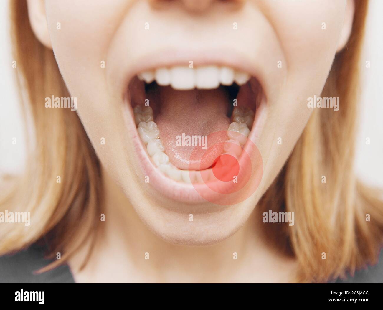 Nahaufnahme der Weibchen mit offenem Mund während oralen Untersuchung beim Zahnarzt. Stockfoto