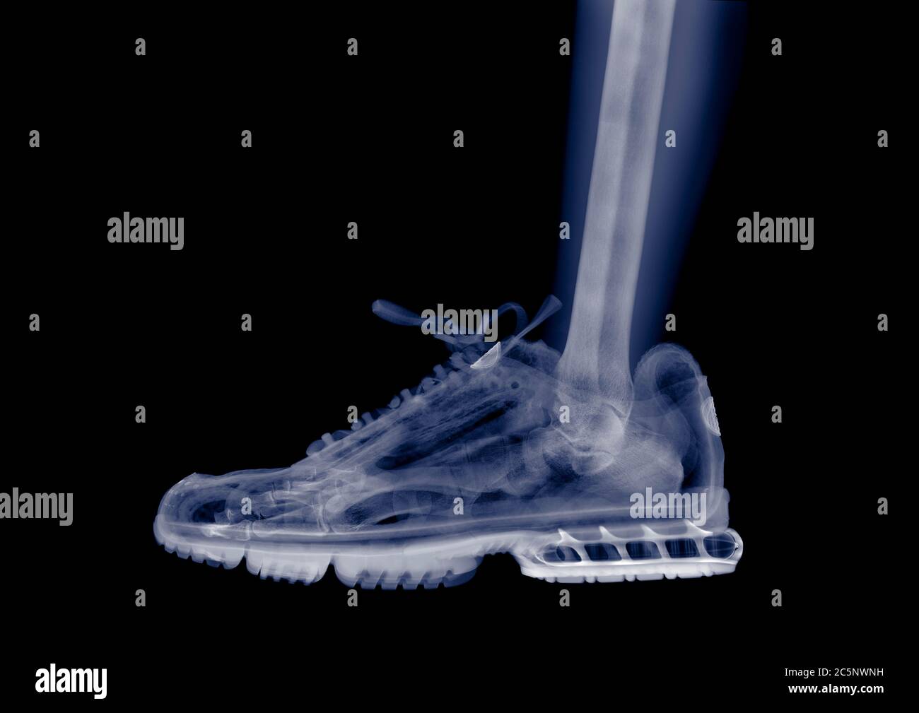 Fuß und Knöchel in einem Laufschuh, farbige Röntgenaufnahme. Stockfoto