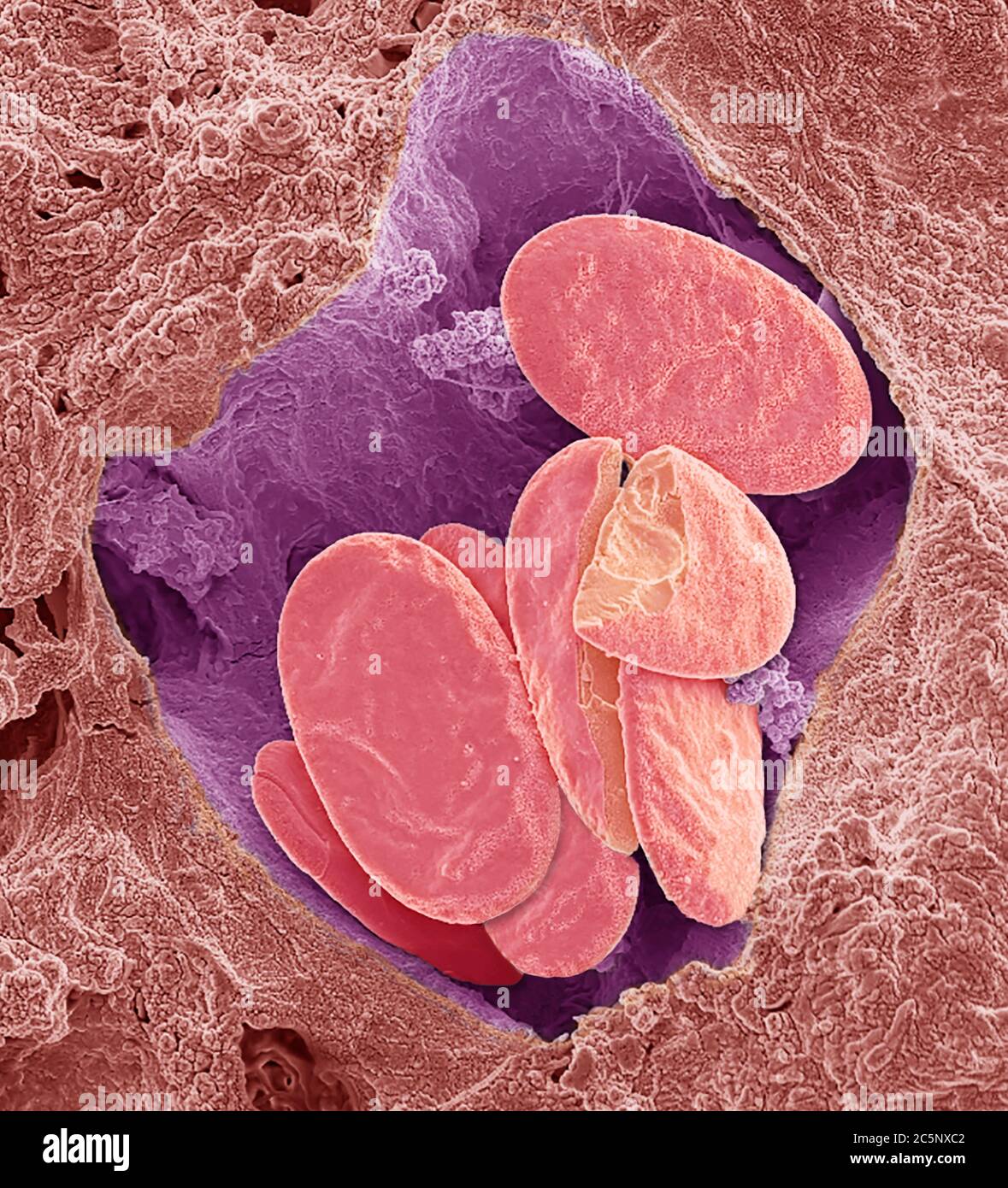 Schlange rote Blutkörperchen. Farbiger Rasterelektronenmikrograph (SEM) von ganzen und gebrochenen roten Blutkörperchen (Erythrozyten, rot) in einem kleinen Blutgefäß einer Schlange. Diese Zellen enthalten Hämoglobin, ein Pigment, das es ihnen ermöglicht, Sauerstoff um den Körper zu transportieren. Nicht-Säugetier rote Blutkörperchen (wie diese) sind oval (discoid) in Form und enthalten einen Zellkern. Menschliche rote Blutkörperchen sind scheibenförmig und haben keinen Zellkern. Vergrößerung: x3000 bei 10 Zentimeter Breite. Stockfoto