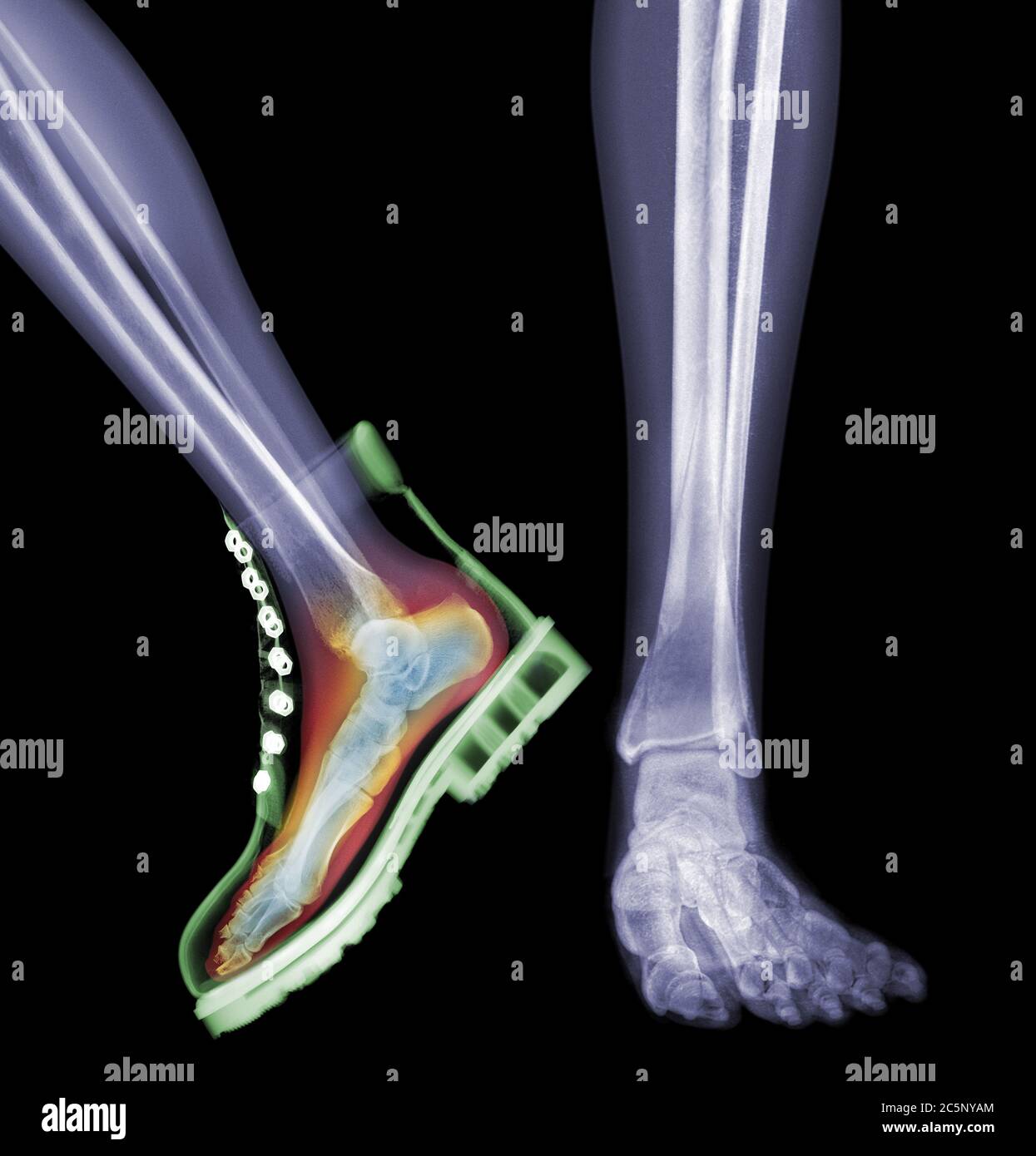 Skelettfüße mit einem Fuß im Stiefel, farbiges Röntgen. Stockfoto