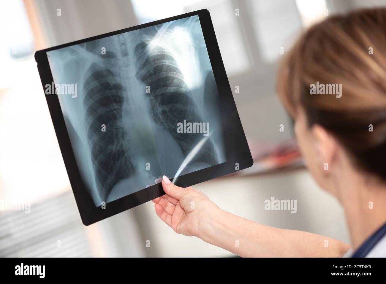 Ärztin, die Röntgenbericht in der Arztpraxis untersucht Stockfoto