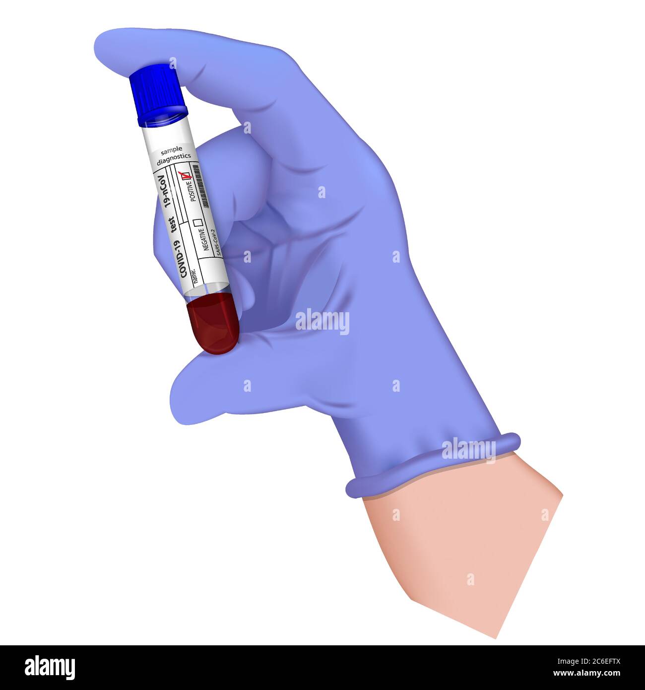 Hand in medizinischen Handschuh hält Reagenzglas mit Blutprobe für die Diagnose Covid 19 Virus. Positives Ergebnis für den Test Coronavirus 2019-nCoV. Realistisches 3d i Stock Vektor