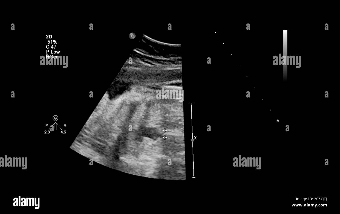 Fetal Stockfotos Und Bilder Kaufen Seite 3 Alamy