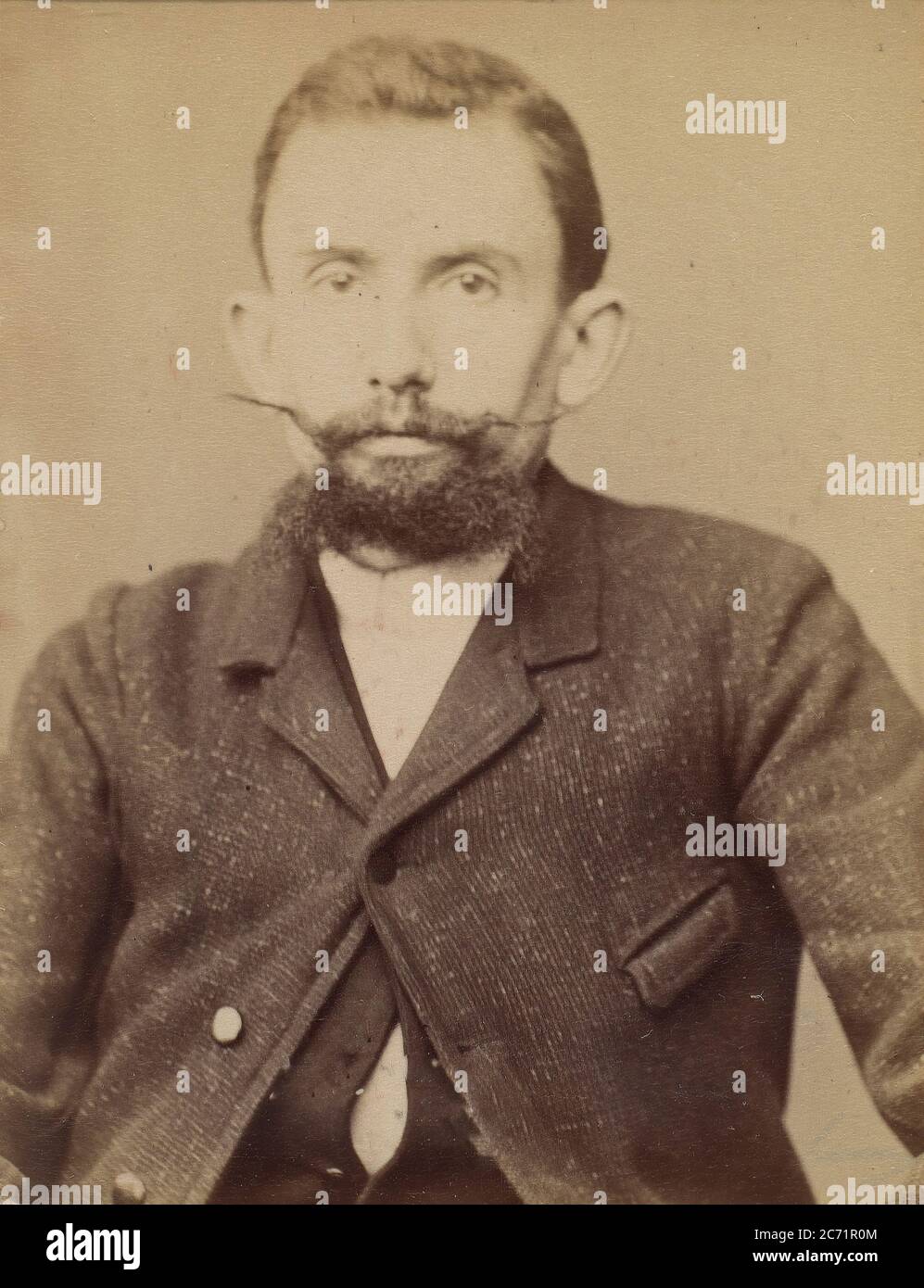 ETI&#xe9;vant. Henri, Achille. 32 ans, n&#xe9; &#xe0; Flammenville (Manche). Typographe. Anarchiste. 94., 1894. Stockfoto