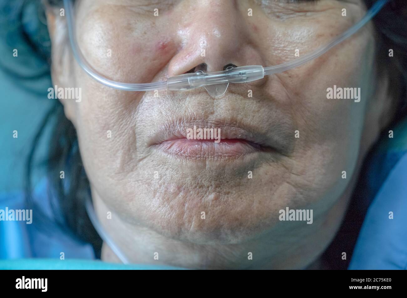 Ältere Frau mit nasalem Atemschlauch, um bei der Atmung zu helfen Stockfoto