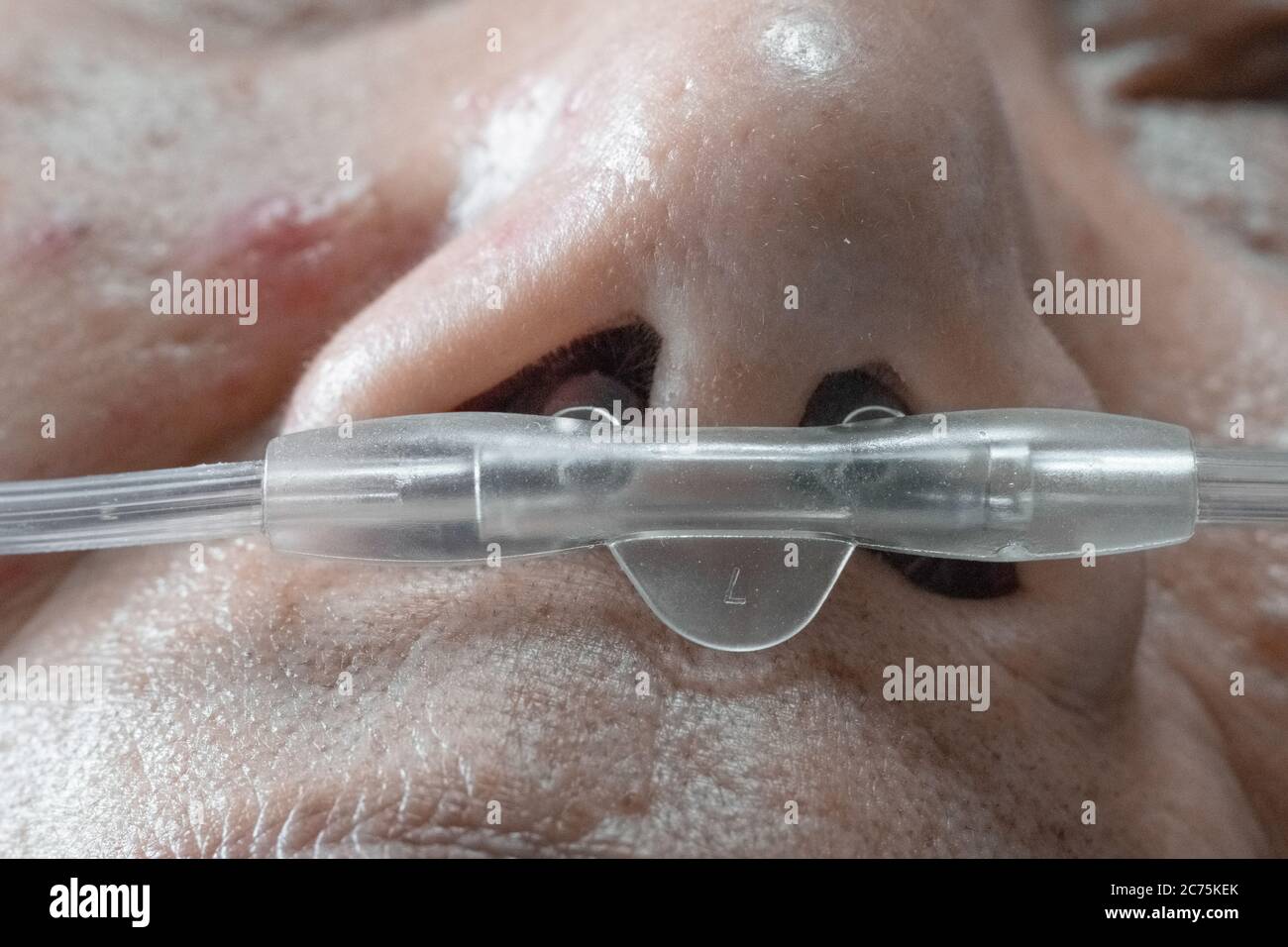 Ältere Frau mit nasalem Atemschlauch, um bei der Atmung zu helfen Stockfoto
