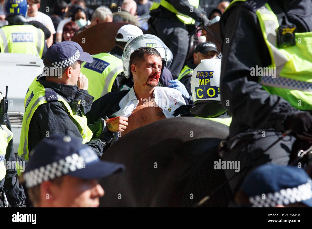 Mann von Demonstranten verletzt As 'Black Lives Matter' und linke Demonstranten versammeln sich in Westminster, um den Sturz von Churchills und anderen Statuen zu fordern, die sie als die imperiale Vergangenheit Großbritanniens betrachten. Die Menge glaubte, dass der Mann einer der rechten Gegendemonstranten war, die die Churchill-Statue früher am Tag verteidigten. Mit: Ansicht wo: London, Großbritannien Wann: 13 Jun 2020 Kredit: Mario Mitsis/WENN Stockfoto