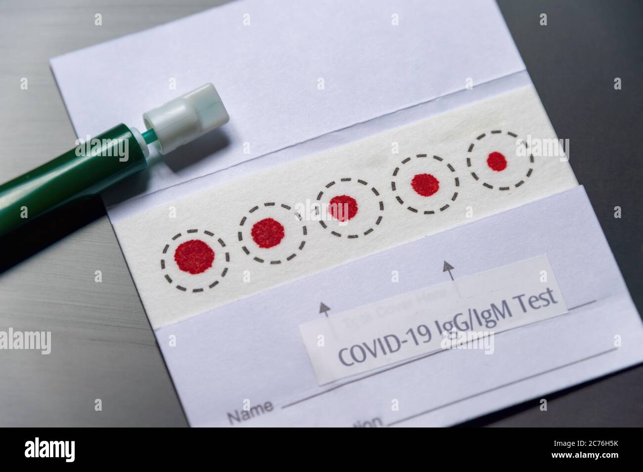 Trockene Blutflecken auf einer Sammelkarte für das Covid-19 IgG/IgM-Antikörperscreening Stockfoto