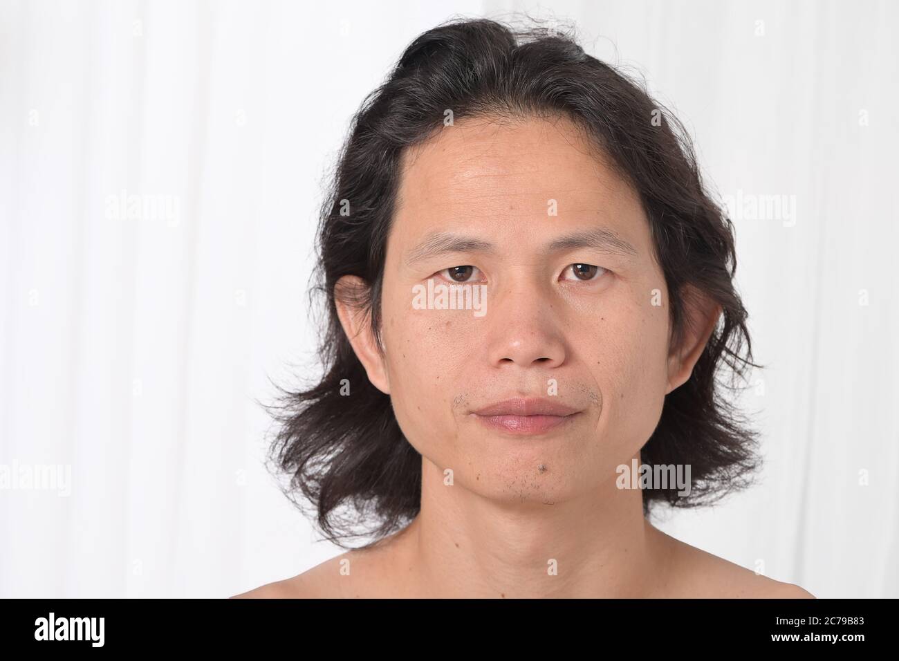 Gesichtsbehandlung: Asiatische Männer im Alter von 35-40 Jahren mit problematischer Haut, Akne-Narben, Falten und dunklen Flecken, Mangel an Hautpflege trockene Haut fehlt Feuchtigkeit Stockfoto