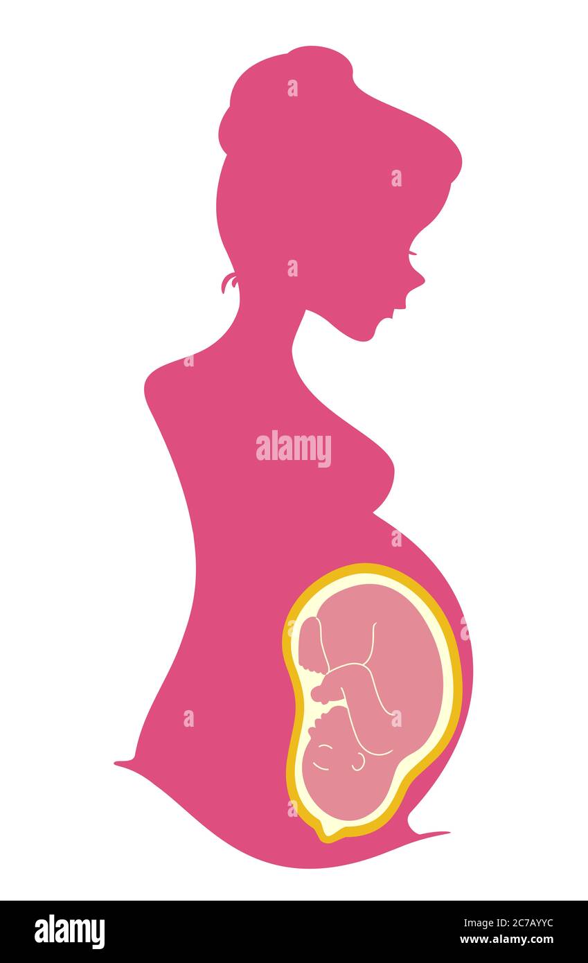 Illustration einer Silhouette schwangere Mädchen zeigt Baby im Mutterleib Stockfoto