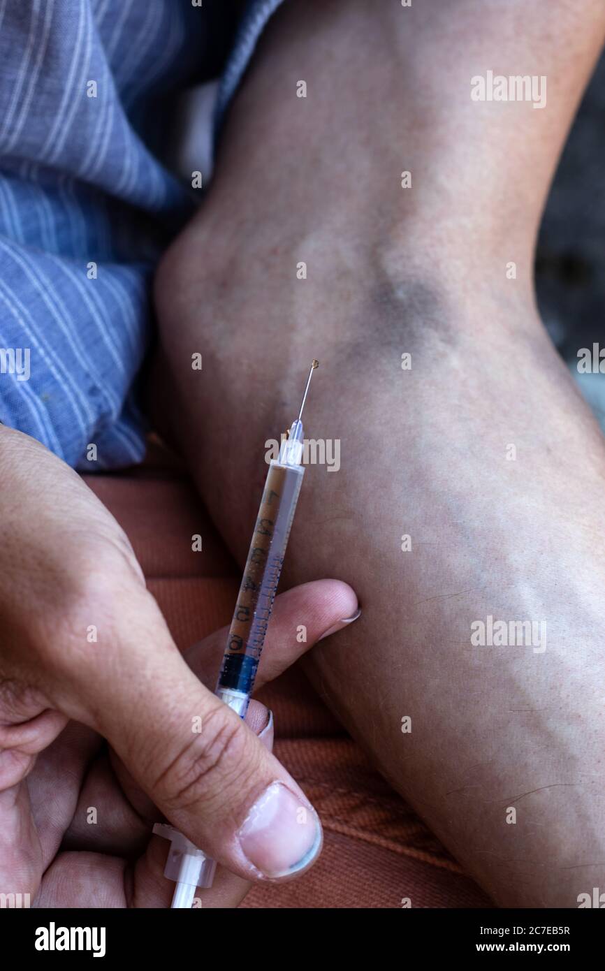 Hände eines Drogenabhängigen mit einer Spritze voll Betäubungsmittel, Heroin oder Kokain in die Armvenen. Drogenabhängigkeit und Entzugserscheinung. Stockfoto