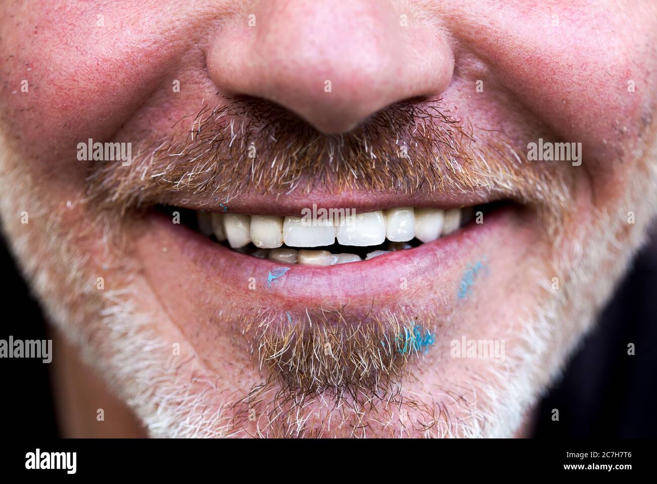 50-jähriger Mann zeigt seine neuen Zähne. Stockfoto