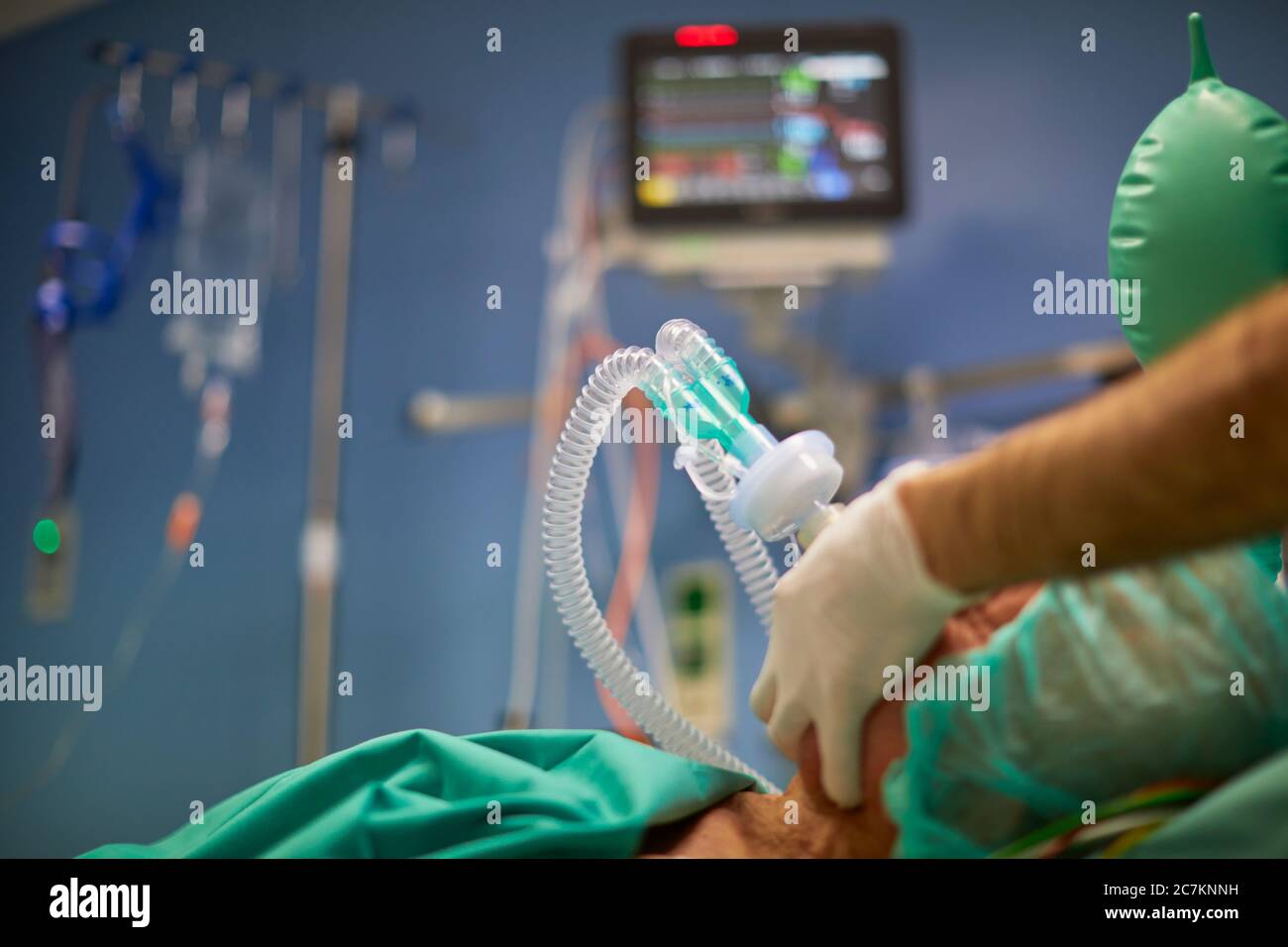 Einleitung der Anästhesie, Maskenbeatmung Stockfoto